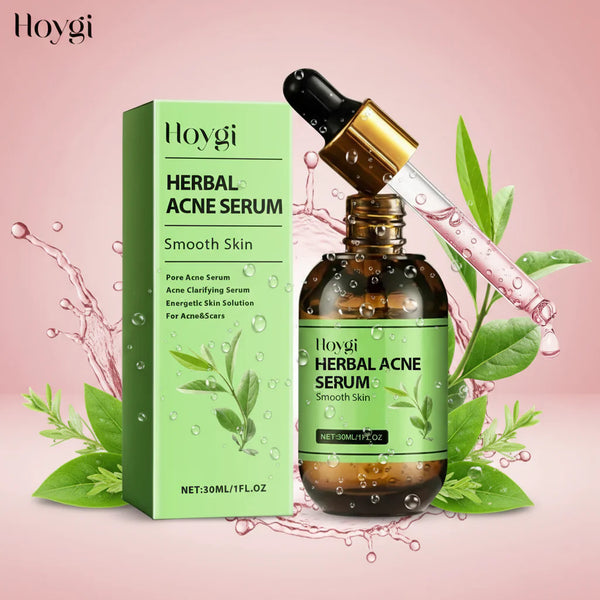 SkinVibe™ ClearBalance — Crème Anti-Acné & Régulatrice de Sébum